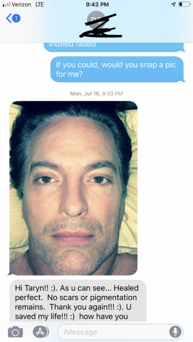 Healed results and happy client text after emergency removal of botched Microblading