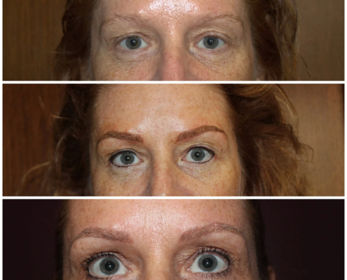 Microblading and Eyelash Enhancement Tattoo (subtle eyeliner tattoo), Before, After and Healed results