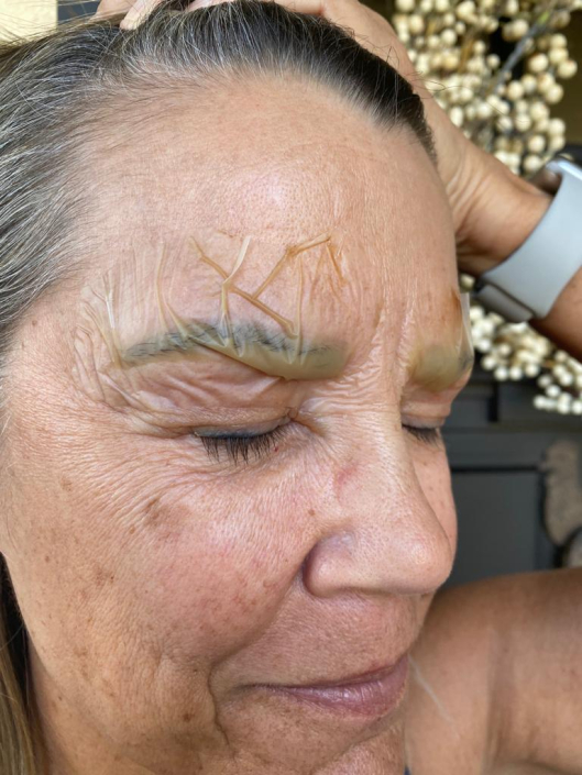 xtract eyebrow healing process aftercare