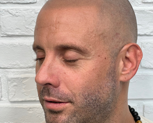 healed scalp micropigmentation